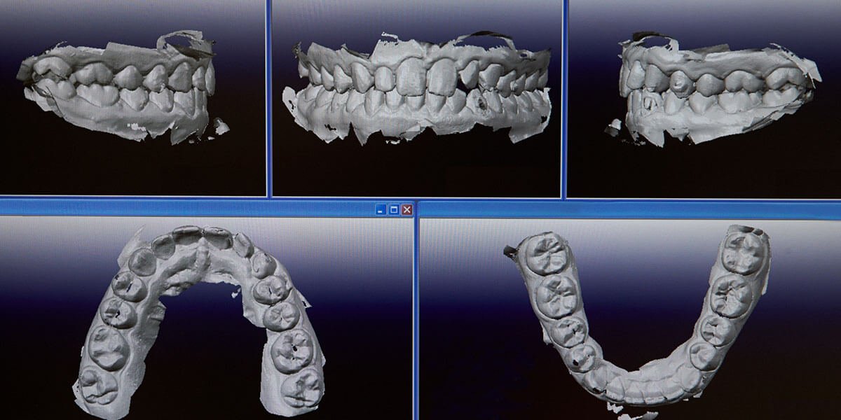Digital Technology - Elite Orthodontics